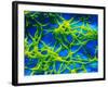 Legionella Pneumophila Bacteria-null-Framed Photographic Print