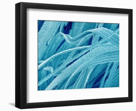 Lens fiber of a rabbit eye-Micro Discovery-Framed Photographic Print