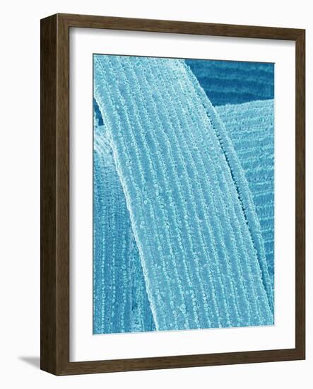 Lens fiber of eye (rabbit)-Micro Discovery-Framed Photographic Print