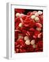 Leukaemia Blood Cells, SEM-Steve Gschmeissner-Framed Photographic Print