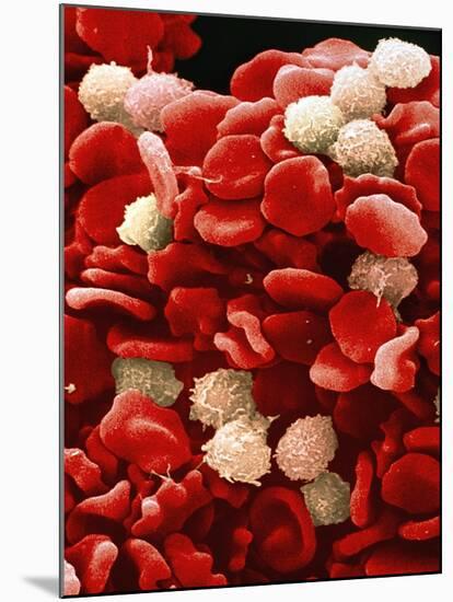 Leukaemia Blood Cells, SEM-Steve Gschmeissner-Mounted Photographic Print