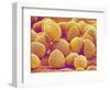 Lily Pollen-Micro Discovery-Framed Photographic Print