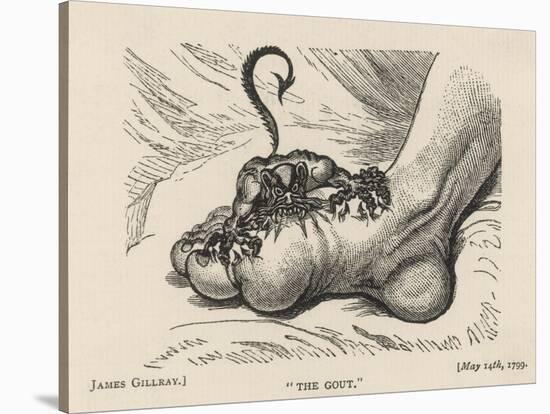 Little Devil Sinks His Teeth into the Swollen Foot of a Gout Sufferer-James Gillray-Stretched Canvas