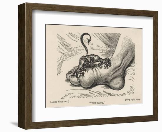 Little Devil Sinks His Teeth into the Swollen Foot of a Gout Sufferer-James Gillray-Framed Art Print