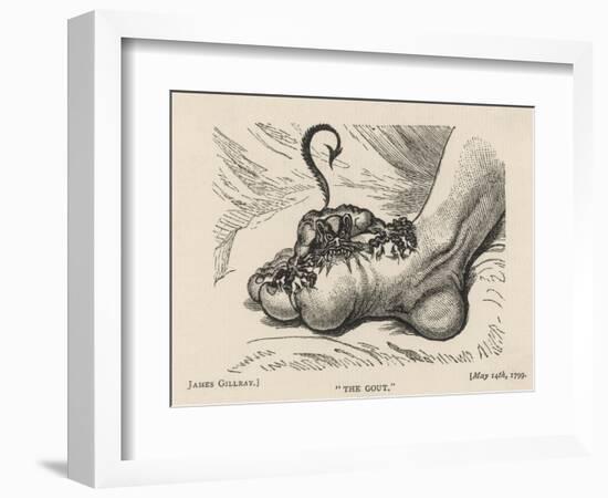 Little Devil Sinks His Teeth into the Swollen Foot of a Gout Sufferer-James Gillray-Framed Art Print