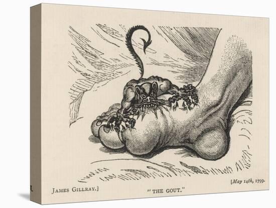 Little Devil Sinks His Teeth into the Swollen Foot of a Gout Sufferer-James Gillray-Stretched Canvas