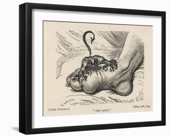 Little Devil Sinks His Teeth into the Swollen Foot of a Gout Sufferer-James Gillray-Framed Art Print