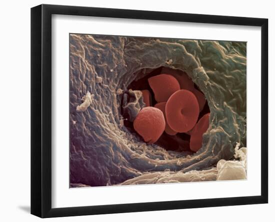 Liver Capillary, SEM-Steve Gschmeissner-Framed Photographic Print