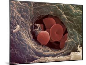 Liver Capillary, SEM-Steve Gschmeissner-Mounted Photographic Print