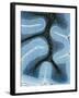 LM of Cortex And Medulla of the Cerebellum-Volker Steger-Framed Photographic Print