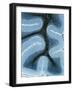 LM of Cortex And Medulla of the Cerebellum-Volker Steger-Framed Photographic Print