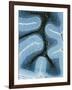 LM of Cortex And Medulla of the Cerebellum-Volker Steger-Framed Photographic Print