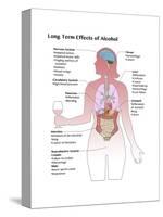 Long Term Effects of Alcohol-Spencer Sutton-Stretched Canvas