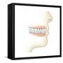 Lower Gums with Braces and Plaque on Teeth-null-Framed Stretched Canvas