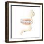 Lower Gums with Braces and Plaque on Teeth-null-Framed Premium Giclee Print