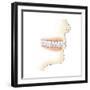 Lower Gums with Braces and Plaque on Teeth-null-Framed Premium Giclee Print
