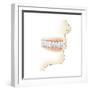 Lower Gums with Braces and Plaque on Teeth-null-Framed Premium Giclee Print