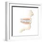 Lower Gums with Braces and Plaque on Teeth-null-Framed Art Print