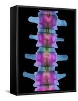 Lumbar Spine, X-ray-Science Photo Library-Framed Stretched Canvas