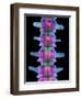 Lumbar Spine, X-ray-Science Photo Library-Framed Premium Photographic Print