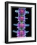 Lumbar Spine, X-ray-Science Photo Library-Framed Premium Photographic Print