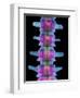 Lumbar Spine, X-ray-Science Photo Library-Framed Premium Photographic Print