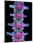 Lumbar Spine, X-ray-Science Photo Library-Mounted Premium Photographic Print