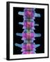 Lumbar Spine, X-ray-Science Photo Library-Framed Premium Photographic Print