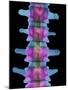 Lumbar Spine, X-ray-Science Photo Library-Mounted Premium Photographic Print