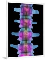 Lumbar Spine, X-ray-Science Photo Library-Framed Photographic Print