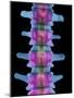 Lumbar Spine, X-ray-Science Photo Library-Mounted Photographic Print