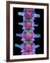 Lumbar Spine, X-ray-Science Photo Library-Framed Photographic Print