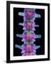 Lumbar Spine, X-ray-Science Photo Library-Framed Photographic Print