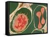 Lung Alveoli And Blood Cells, TEM-Thomas Deerinck-Framed Stretched Canvas