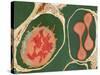 Lung Alveoli And Blood Cells, TEM-Thomas Deerinck-Stretched Canvas