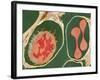 Lung Alveoli And Blood Cells, TEM-Thomas Deerinck-Framed Photographic Print
