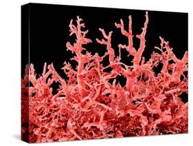 Lung Blood Vessels, SEM-Susumu Nishinaga-Stretched Canvas