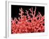 Lung Blood Vessels, SEM-Susumu Nishinaga-Framed Photographic Print