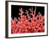 Lung Blood Vessels, SEM-Susumu Nishinaga-Framed Photographic Print