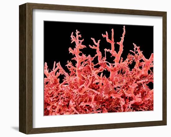 Lung Blood Vessels, SEM-Susumu Nishinaga-Framed Photographic Print