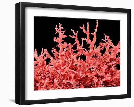 Lung Blood Vessels, SEM-Susumu Nishinaga-Framed Photographic Print