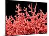 Lung Blood Vessels, SEM-Susumu Nishinaga-Mounted Photographic Print