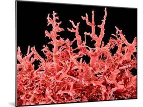 Lung Blood Vessels, SEM-Susumu Nishinaga-Mounted Photographic Print