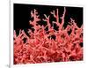 Lung Blood Vessels, SEM-Susumu Nishinaga-Framed Photographic Print