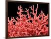 Lung Blood Vessels, SEM-Susumu Nishinaga-Framed Photographic Print