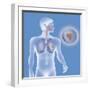 Lung Cancer, Drawing-Caroline Arquevaux-Framed Giclee Print