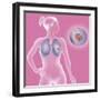 Lung Cancer, Drawing-Caroline Arquevaux-Framed Giclee Print