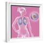 Lung Cancer, Drawing-Caroline Arquevaux-Framed Giclee Print