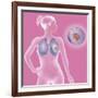 Lung Cancer, Drawing-Caroline Arquevaux-Framed Giclee Print