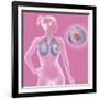 Lung Cancer, Drawing-Caroline Arquevaux-Framed Giclee Print